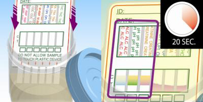 サンプルパッドの先が本体(プラスチック部分：赤い線より先)に触れないよう注意しながら、先端を尿検体に先端を尿検体に浸け約20秒待ちます。