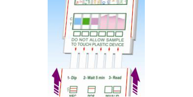 尿検体からサンプルパッドを取り出して、カバーを元に戻し、結果を判断します。